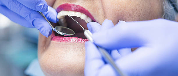 Best Emergency Dental Care for Broken or Chipped Teeth in Smyrna, DE